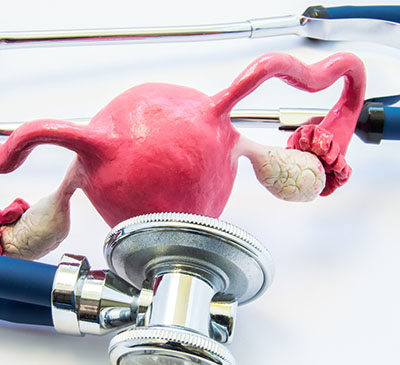 Global Endometrial Ablation Devices Market 2019-2023